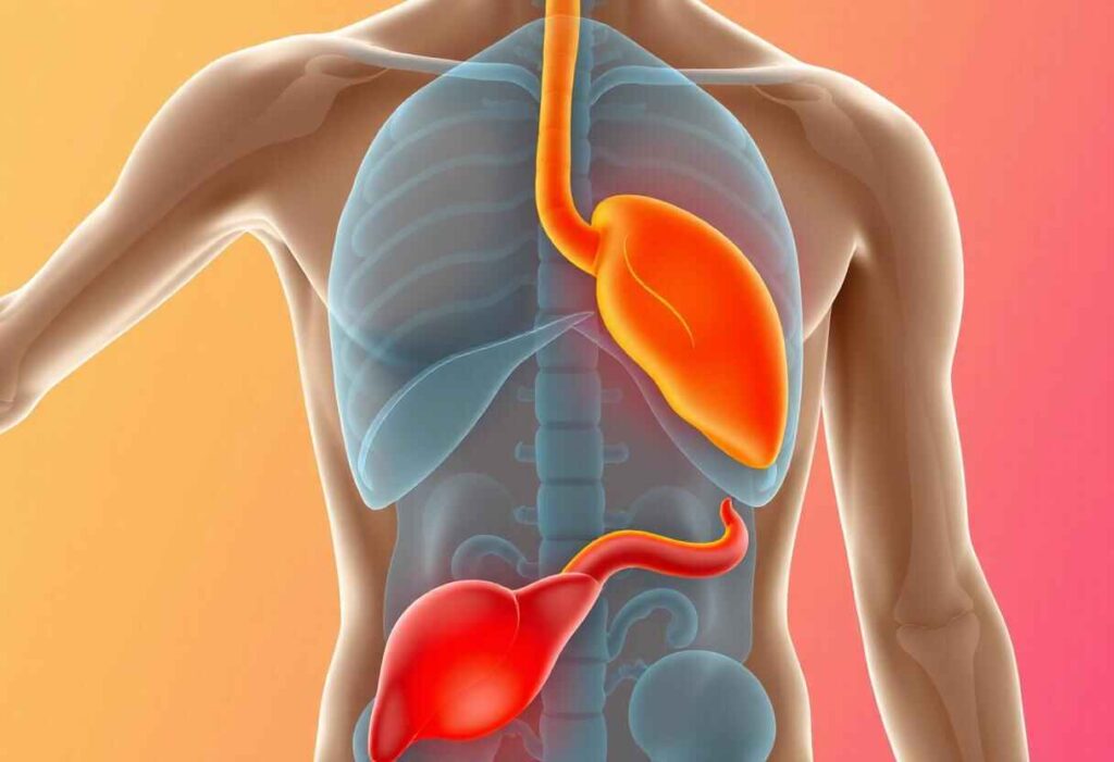 Medical diagram showing the symptoms of gallstone pain, with arrows pointing to the upper abdomen and radiating areas like the back and shoulder.